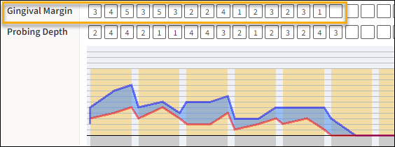 Perio Chart with yellow highlight box around the Gingival Margin row with corresponding entries.